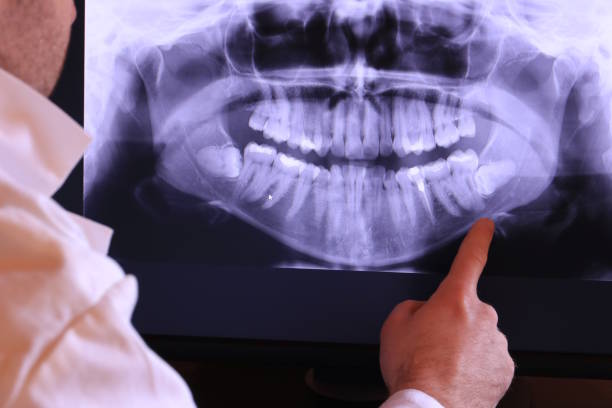Best Urgent Care for Lost Fillings or Crowns in Olmos Park, TX